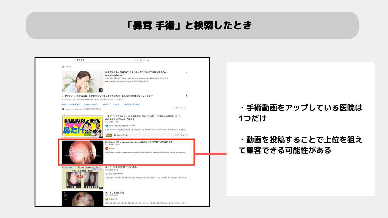 クリニック集客にYouTubeを活用する方法