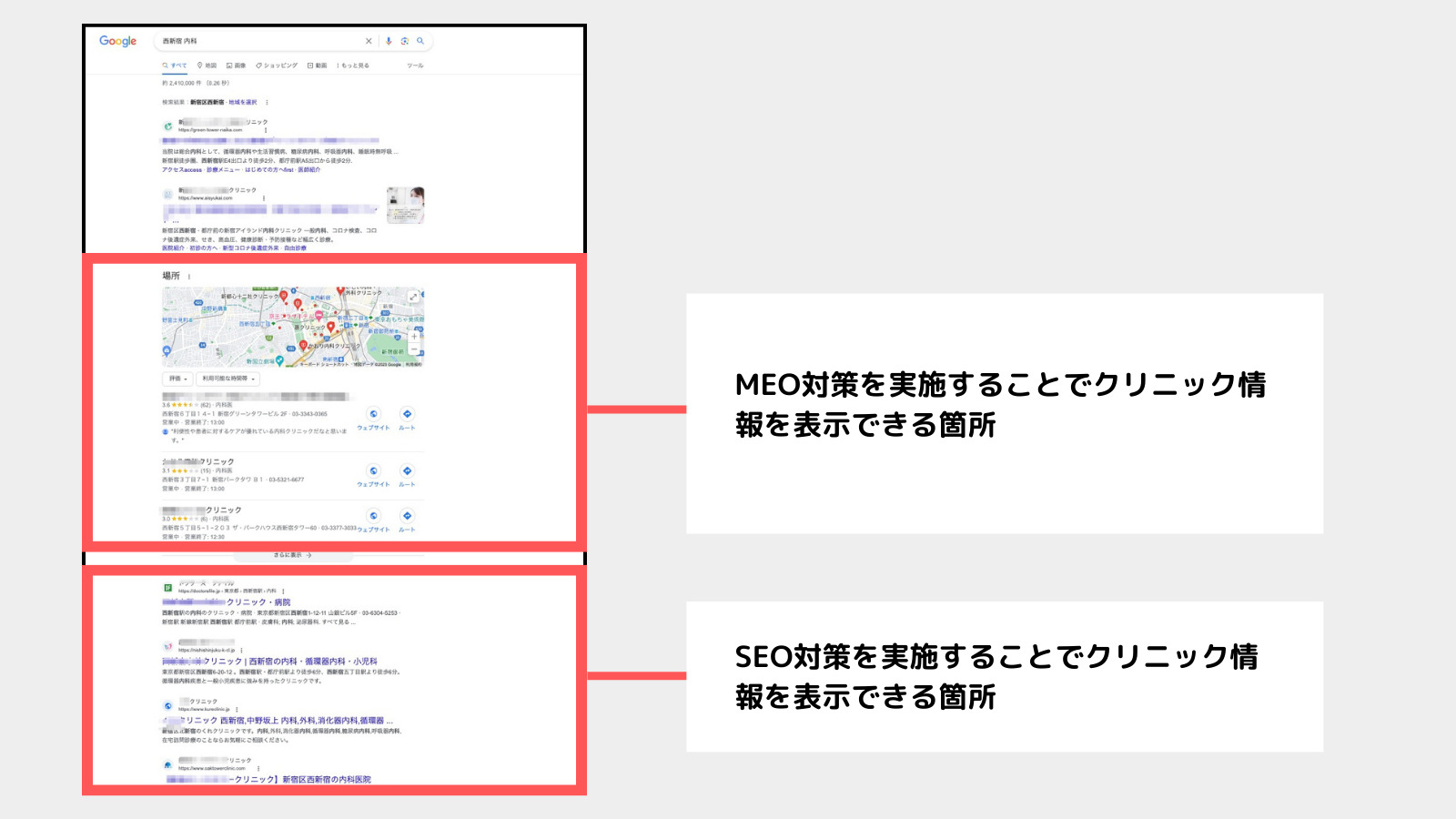 クリニック集客におけるSEO対策とMEO対策