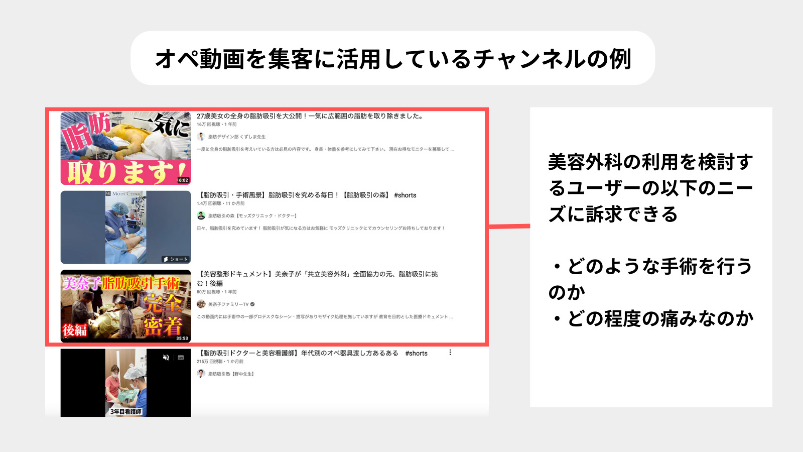 YouTube成功事例_美容外科